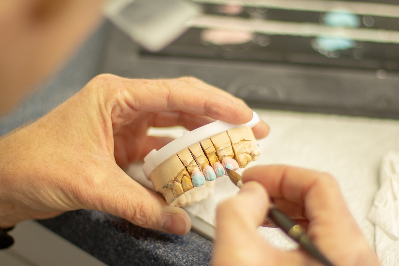 12 Things You Should Know About Dental Prosthetics