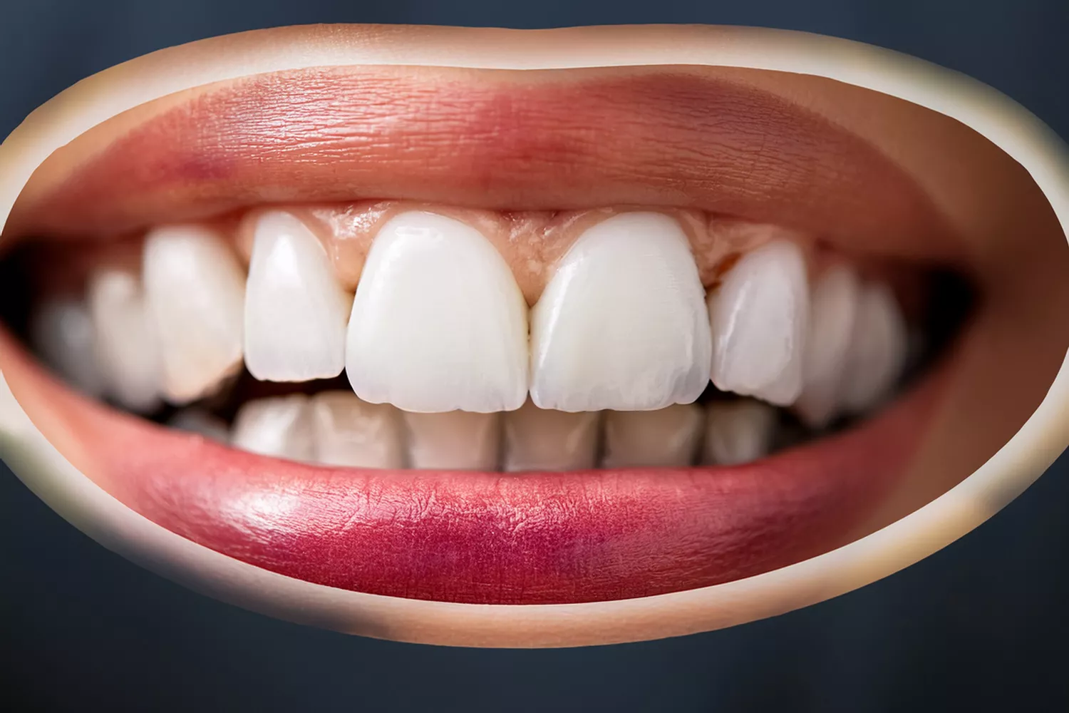 How Do You Decide the Size of My Teeth?” A Deep Dive into Digital Smile Design and Tooth Proportions
