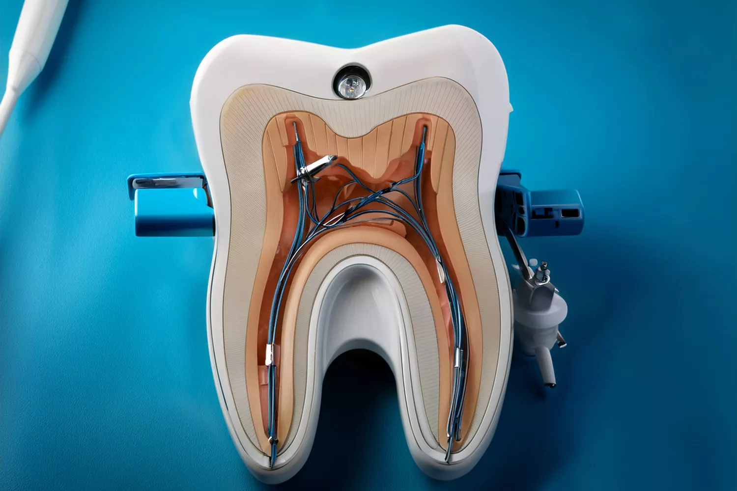 From Toothache to “Tooth Rescue” – How Emergency Dentistry Really Works at Milim Dental Bursa