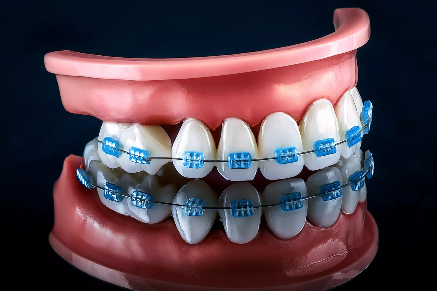 Düz Dişler, Sağlıklı Çeneler: Ortodontinin Sadece Görünüşle İlgili Olmamasının Nedenleri