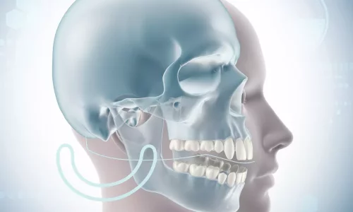 Kan käksmala orsaka korsbett? - Milim Dental Hospital