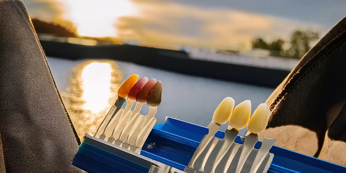 «Как Вы выбираете цвет моих зубов?»