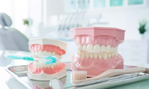 Kreuzbiss bei Kindern vs. Erwachsenen: Warum der Zeitpunkt wichtig ist - Milim Dental Hospital