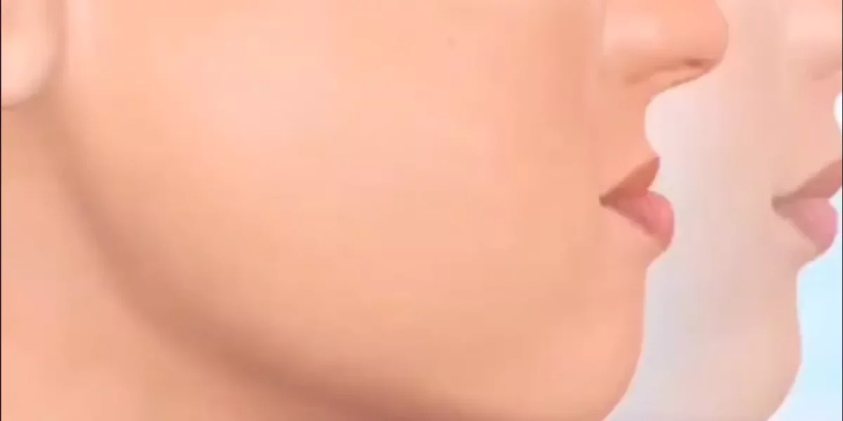 Can My Jaw Structure Be Corrected with Orthodontics, or Is Surgery Necessary?