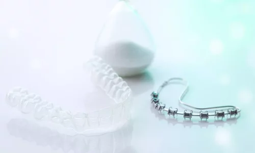 교정 치료는 보통 얼마나 걸리나요? - Milim Dental Hospital