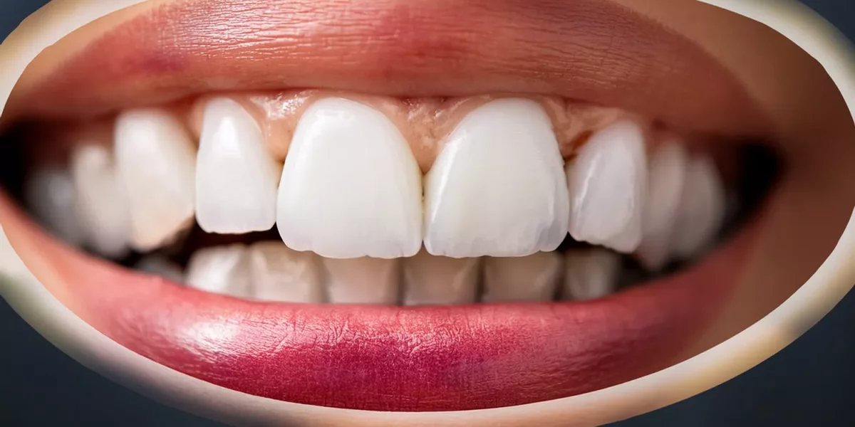 Как определить размер моих зубов? Глубокое погружение в Digital Smile Design и пропорции зубов