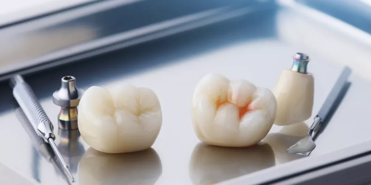 Materials Explained: Zirconia vs Emax, Screw-Retained vs Cemented