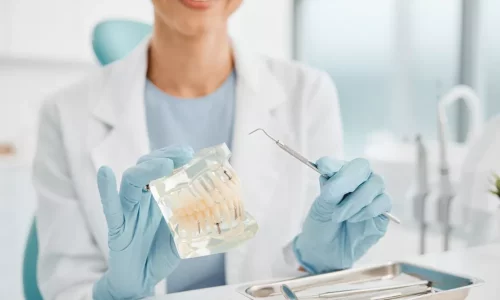 Zijn keramische beugels kwetsbaarder? - Milim Dental Hospital
