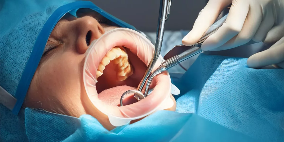 Tooth Extraction in Patients with Intellectual Disabilities