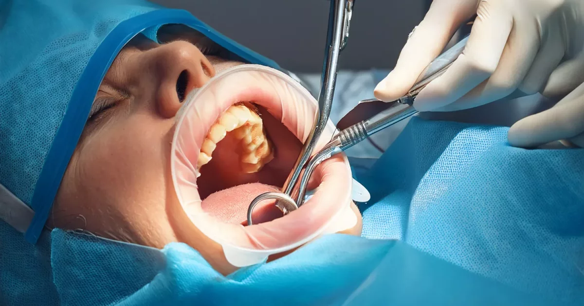 Tooth Extraction in Patients with Intellectual Disabilities | Milim Dental  Hospital