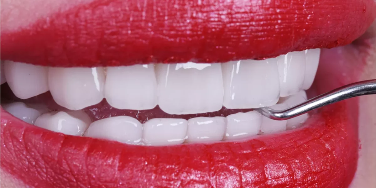 Hollywood Smile Turkey: 7 Myths Debunked by an Oral Surgeon