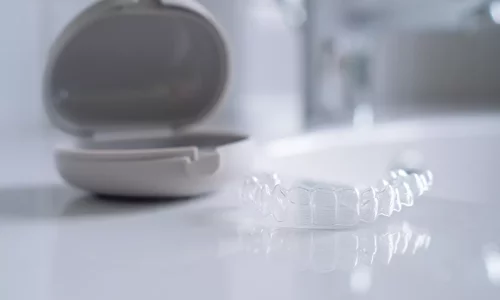 Дали носачите се вклучени по Invisalign? - Milim Dental Hospital
