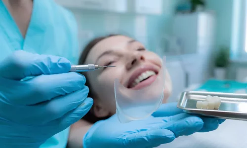 貼面牙齒修磨：有必要嗎？ - Milim Dental Hospital