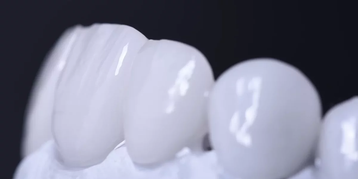 Emax vs Zirconia: Cila duket më natyrale në dritën e ditës? (Perspektiva Holandeze)
