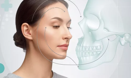 Was sind die Anzeichen für eine Kieferverengung? - Milim Dental Hospital