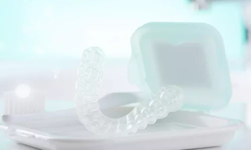 治療後に使われるリテーナーは何ですか？ - Milim Dental Hospital