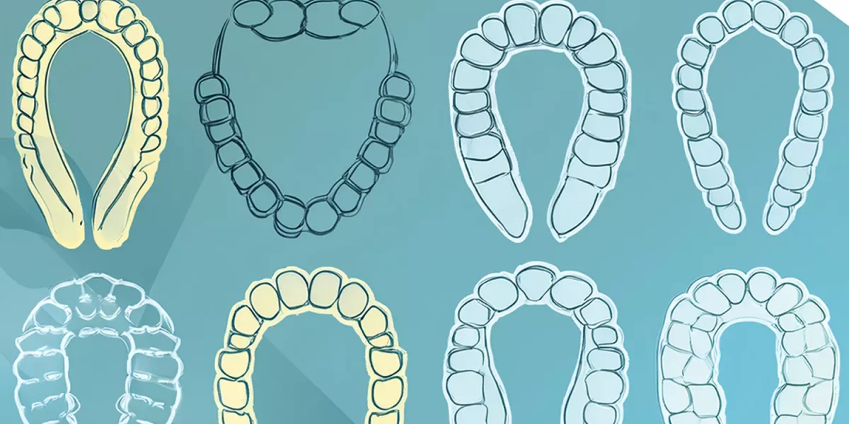 Все ли прозрачные элайнеры одинаковы?