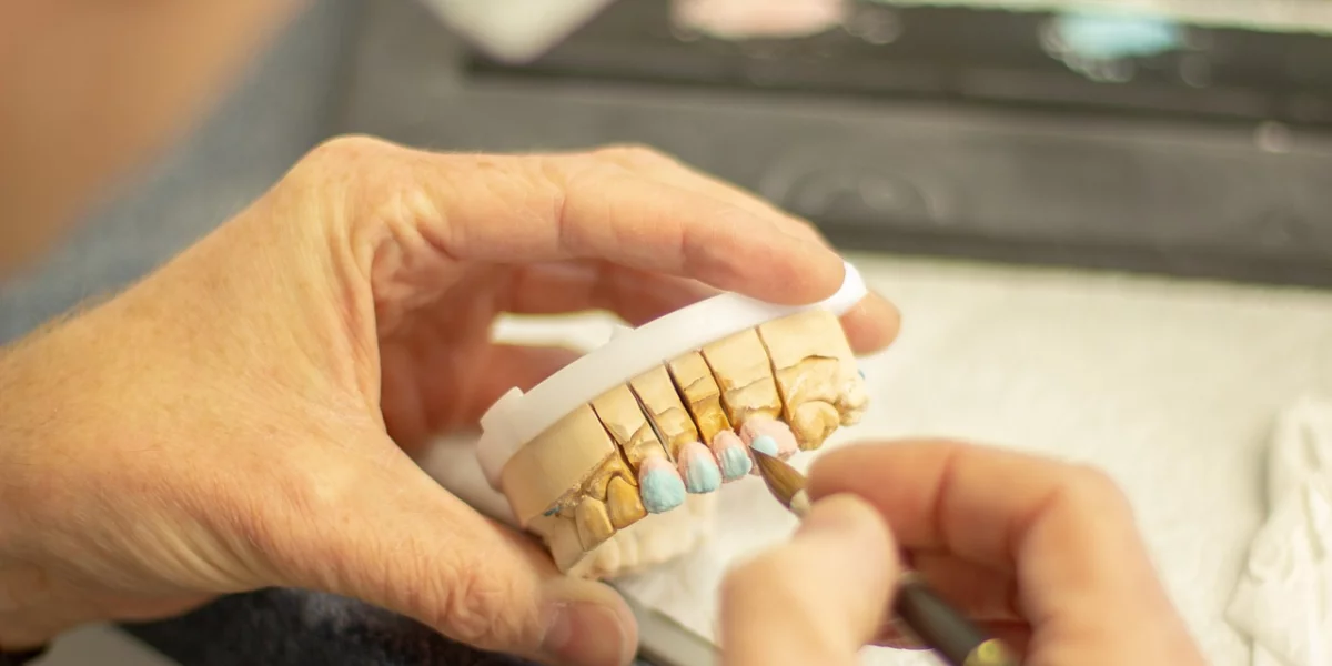 12個你應該了解的牙科假牙