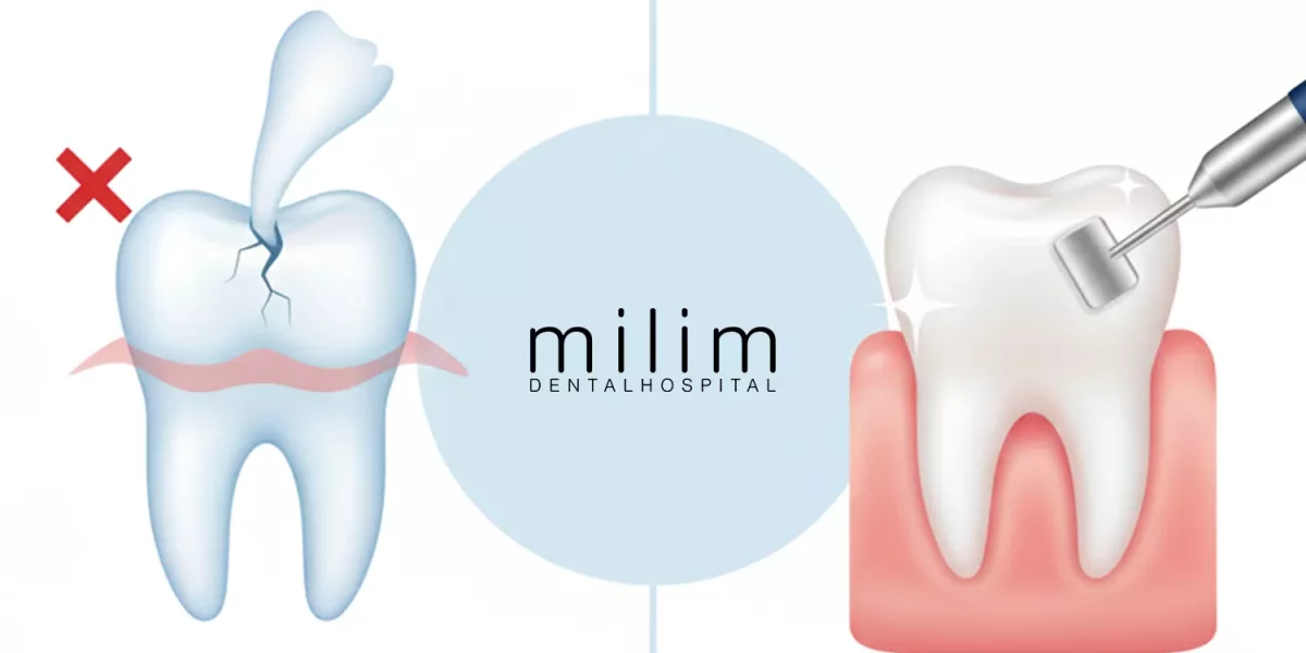 歯石除去は害がありますか？