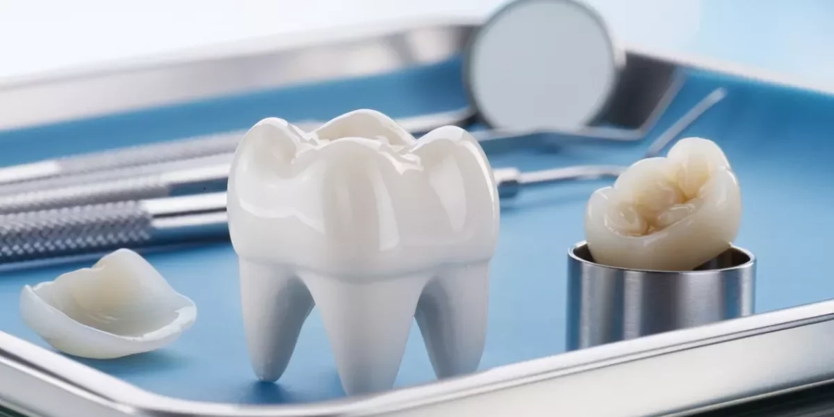 Long-Term Maintenance (Veneers & Crowns)