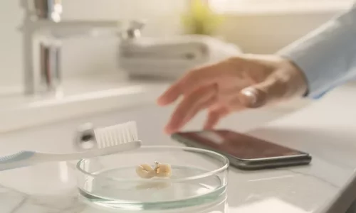 Was tun, wenn ein Veneer nach der Rückkehr nach Hause absplittert - Milim Dental Hospital