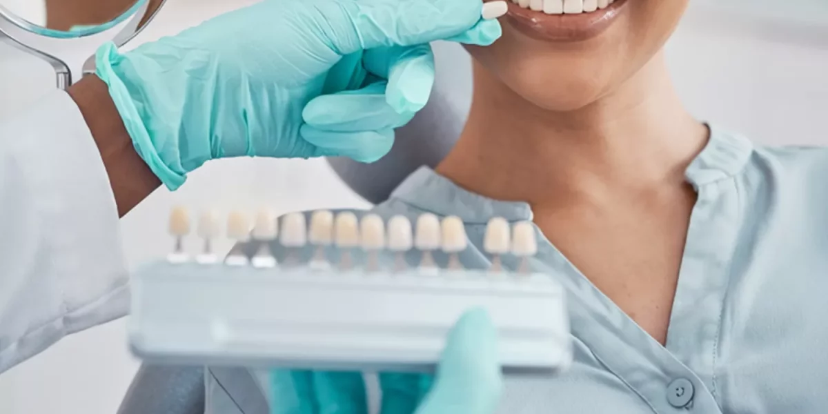 Try-In Appointment: Why It’s the Most Important Step in Smile Design