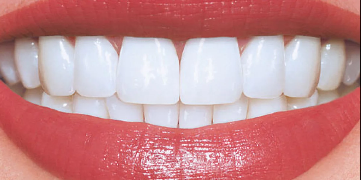 지르코니아 크라운에 대해 알아야 할 모든 것