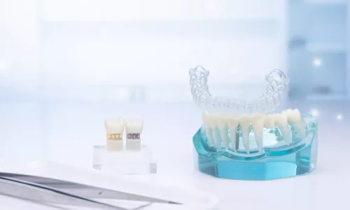 Welche Rolle spielen Attachments? - Milim Dental Hospital