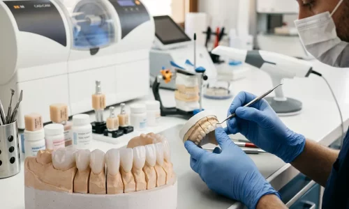 What Really Affects the Cost of a Hollywood Smile? - Milim Dental Hospital