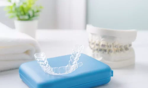 ¿Qué retenedor se usa después de los brackets cerámicos? - Milim Dental Hospital