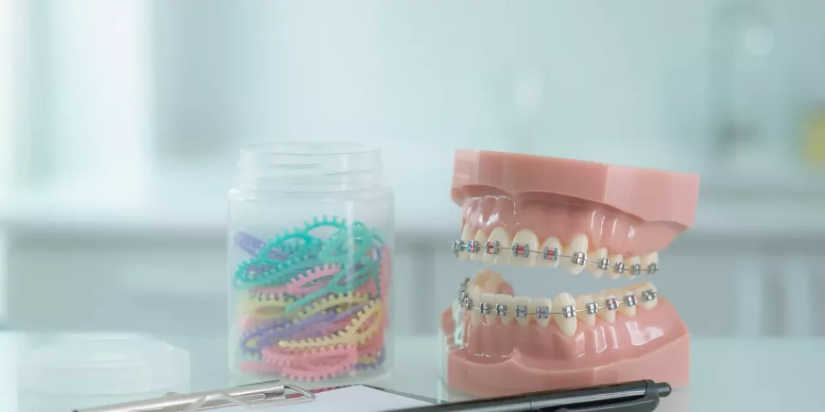 Braces Prices in Bursa