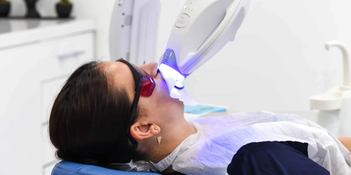 什麼是牙齒美白，為什麼它是必要的？