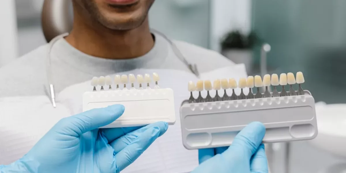 “Turkey Teeth” Myths (Veneers vs Crowns) FAQ 9.1 — Are crowns always required for a Hollywood smile?