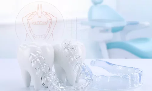 Tandgnissling och Ortodonti - Milim Dental Hospital