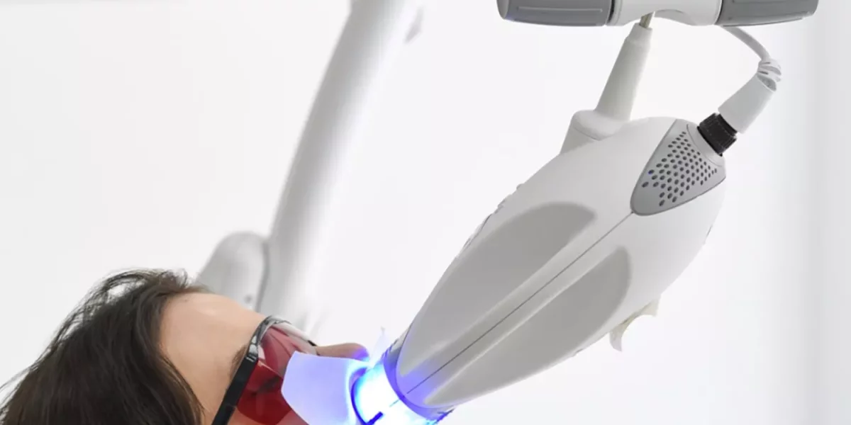 Teeth Whitening Safely – What You Must Know Before Bleaching Your Smile