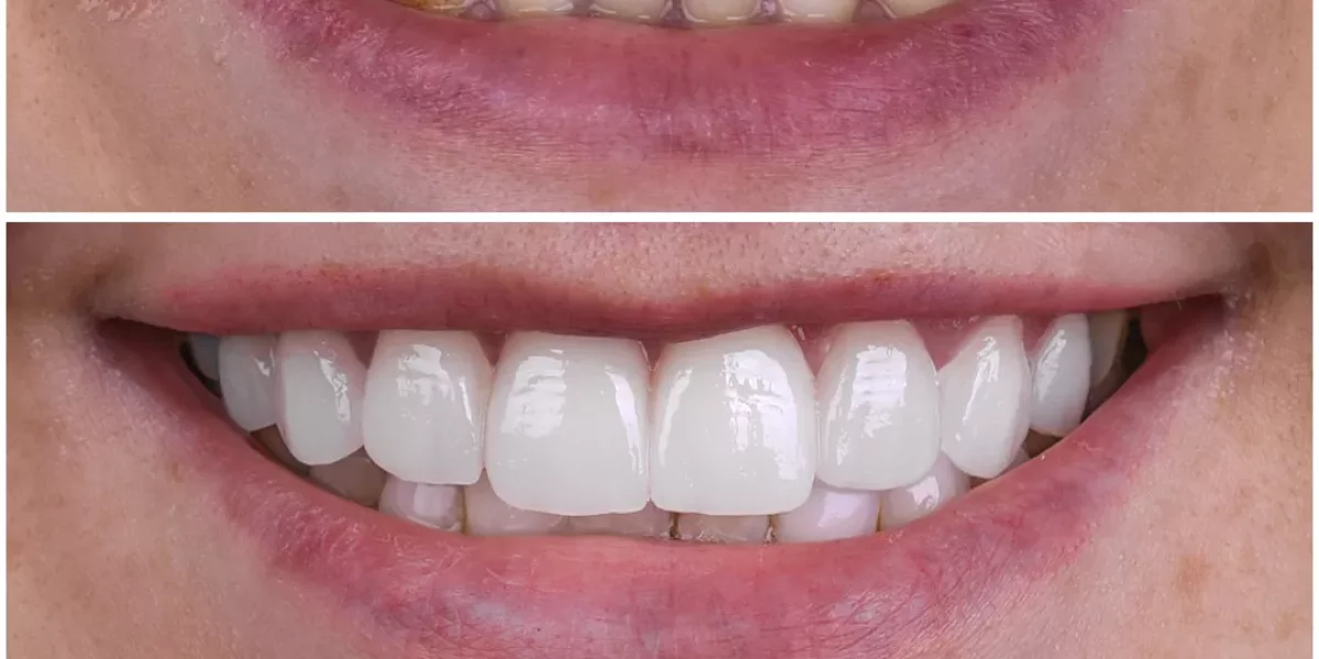 MilimInternational before and after