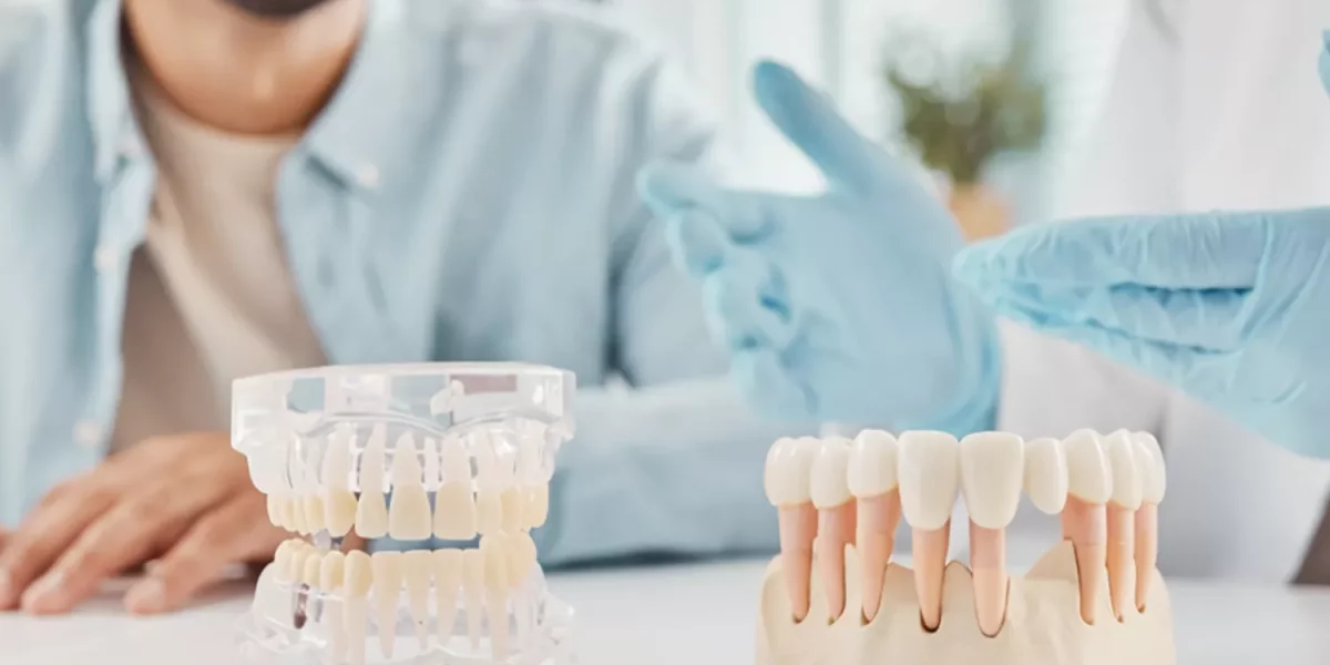 Smile Makeover Turkiet: Fasader eller kronor—Vilket passar dig?