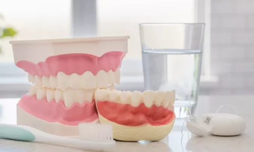 歯周病（歯肉炎）：見逃してはいけない初期のサイン - Milim Dental Hospital