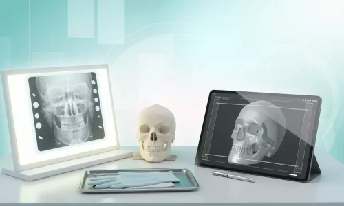 Ai-je besoin de radiographies ou de scans numériques ? - Milim Dental Hospital