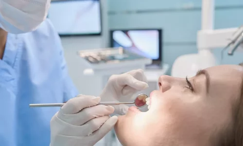 IPR (Interproximal Reduction): Is Teeth Shaving Necessary? - Milim Dental Hospital