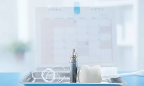 Dental Implants Maintenance Schedule Turkey - Milim Dental Hospital