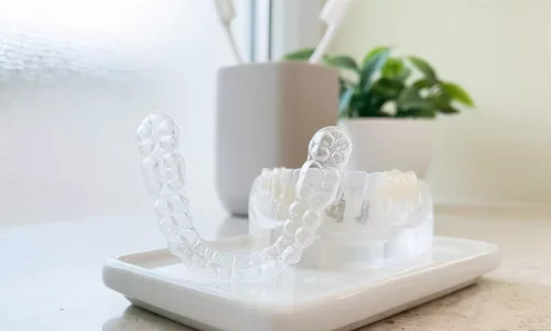 磨牙症（咬紧）+正畸：你还能做Invisalign吗？ - Milim Dental Hospital