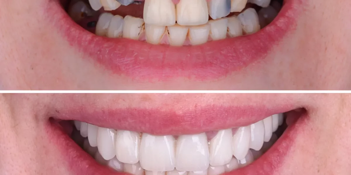 A Mund të Ndryshojë Vërtet Një Buzëqeshje Më e Mirë Jetën e Përditshme?