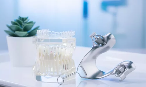 Kan aligners hjälpa efter expansion? - Milim Dental Hospital