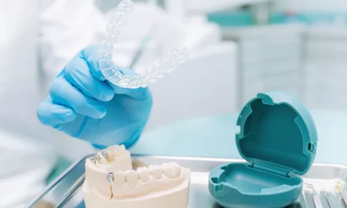 Cum funcţionează rafinările? - Milim Dental Hospital