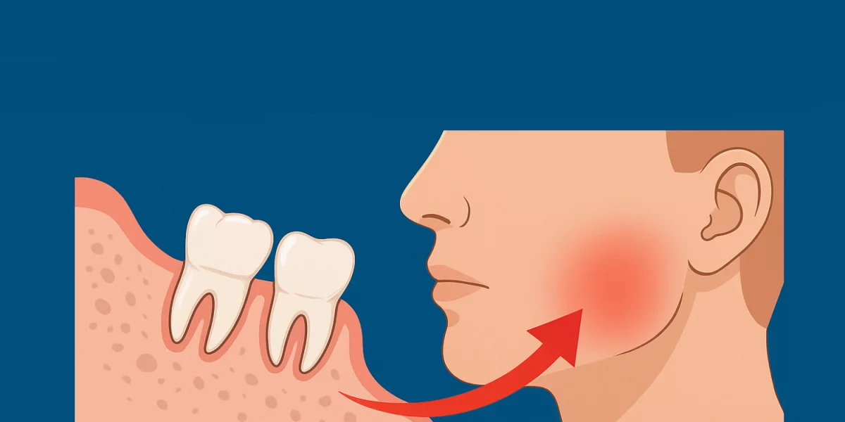 Verzwakte verstandskies extractie en gevoelloosheid risico