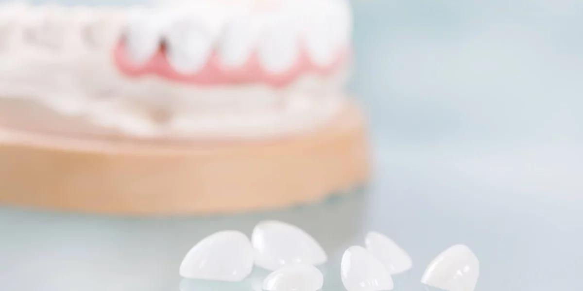 How Long Do Veneers Last and How to Care for Them?