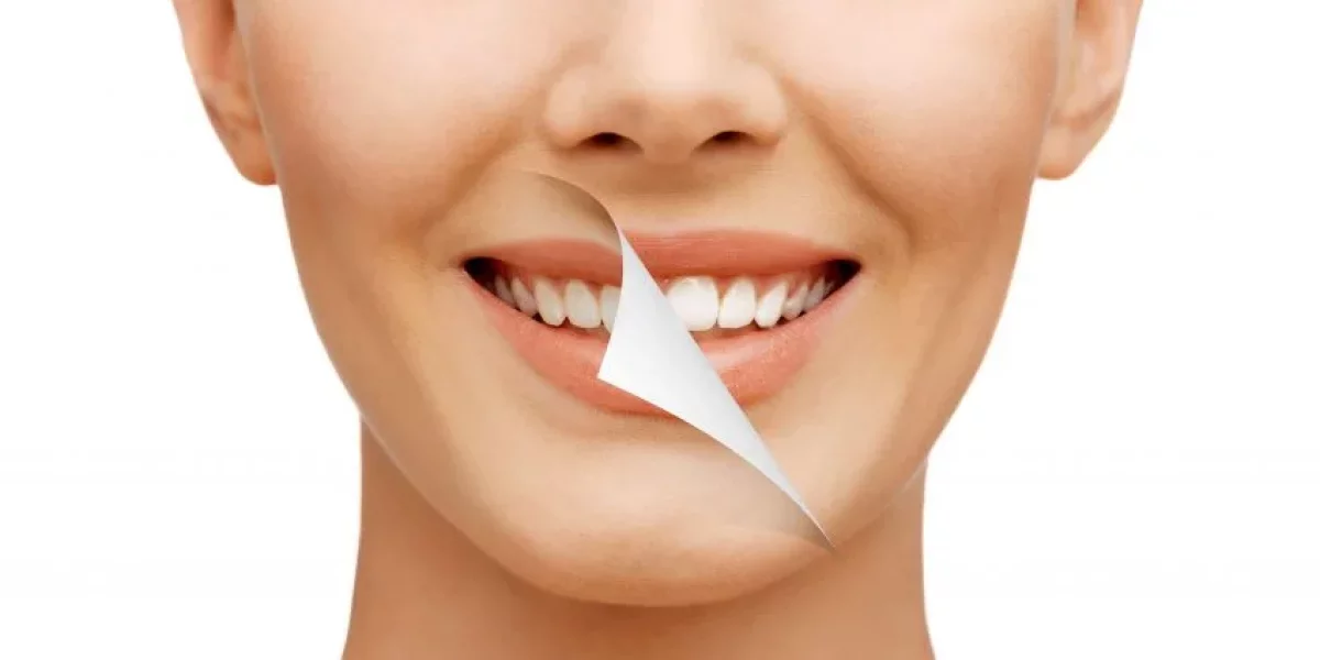 Smile Makeover in Turkey: How Milim Dental Helps You Gain Confidence Again