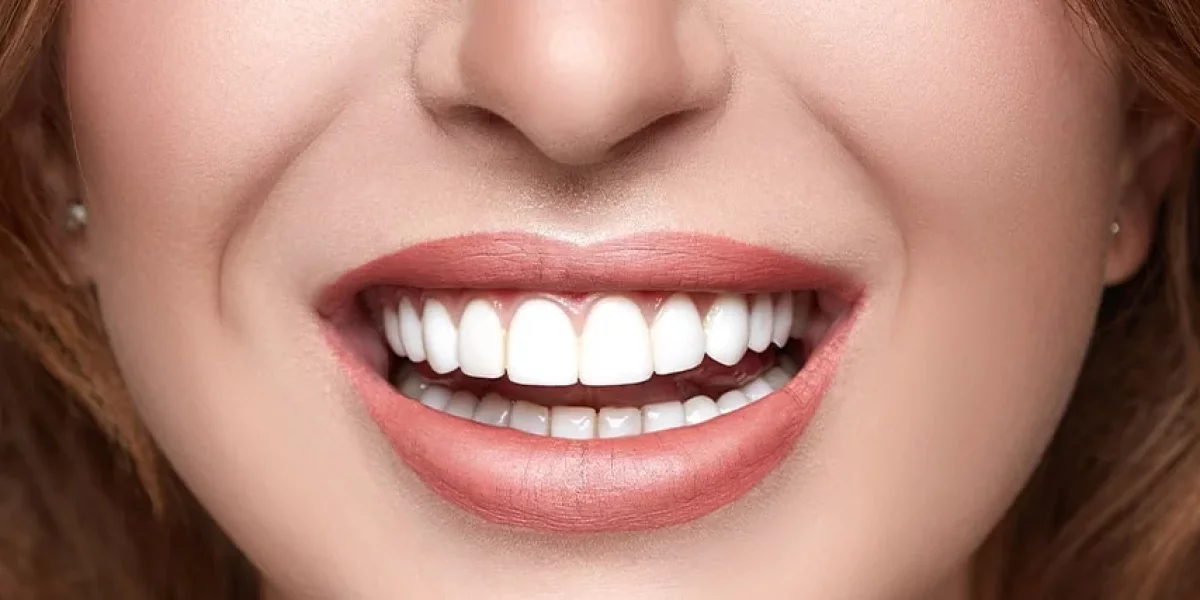 Why Getting a Hollywood Smile in Turkey is the Smartest Investment for Your Confidence