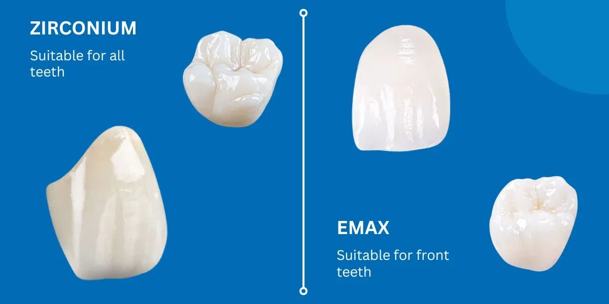 Why is Zirconia More Affordable than E-Max? Key Differences Explained